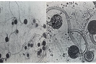 Insight into Secondary Metabolites of Circinella, Mucor and Rhizopus the Three Musketeers of Order…