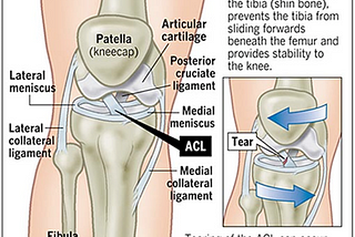 EXPERIMENT> Wearable ACL Tear Detector