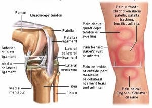 total knee replacement surgery cost, knee transplant surgery