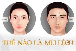 Sửa mũi lệch giá bao nhiêu? Chi phí sửa mũi lệch có mắc không?