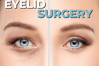 Transforming Gaze: The Art and Science of Eyelid Surgery