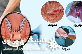 درد هنگام دفع مدفوع به دلیل یبوست
