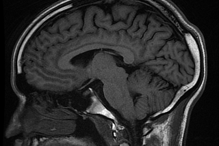 Ultra-High Fields (UHF) Human MRI: Living Brain imaged with 11.7 Tesla MRI of Iseult Project