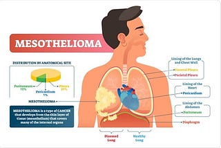 What is mesothelioma?