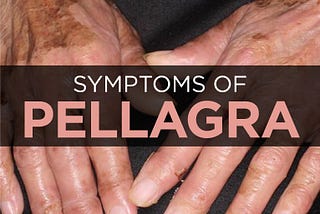 Pellagra: Symptoms, Causes & Treatment | BulkSupplements.com