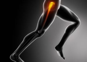 Los Angeles Orthopedic Hip Injury