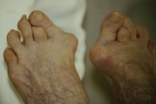 Pare de glamorizar a dor de sapatos de salto alto