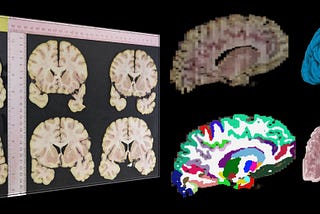 Calculating the brain from plain dissection photographs