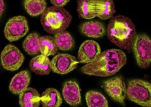 Who Was the Most Important Woman in Modern Science: The Story of Henrietta Lacks