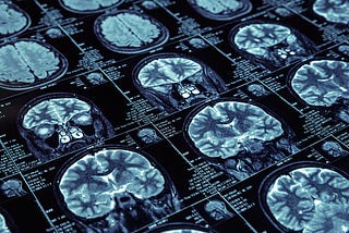 Revolutionizing Disease Diagnosis: How Machine Learning is Transforming Medical Imaging