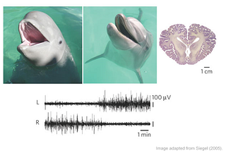 Night watch in the brain: recent findings on first-night-in-new-place insomnia.