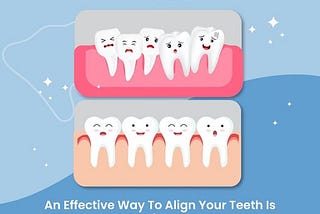 Teeth cleaning cost in Bangalore