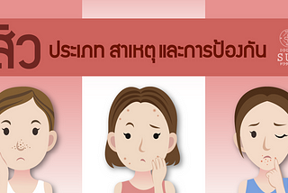 เรื่องสิว สิว…ประเภทของสิว สาเหตุ..และการป้องกัน