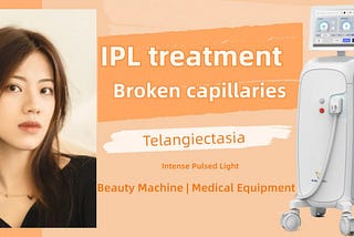 IPL treatment for broken capillaries and intense pulsed light to reduce telangiectasia