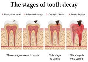 Oral Hygiene during the Pandemic: Role of Complementary Oral Care