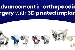 Advancement in orthopaedic surgery with 3D printed implants — 3DIncredible