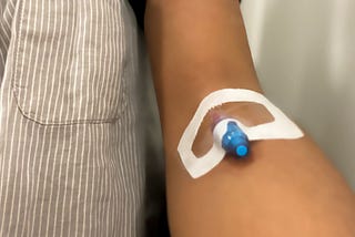 What It Was Like to Get My First Infusion Treatment for M.E.
