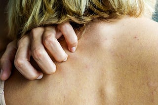 What Cause Psoriasis Symptoms ? — FASTWAY BLOG