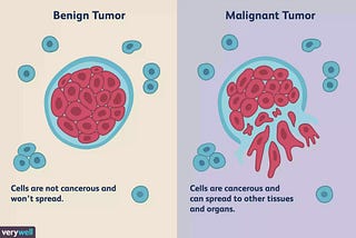 Machine Learning — Logistic Regression Model for Breast Cancer Probability & Detection