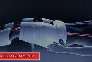 Why EECP treatment | saaol eecp | Best #1