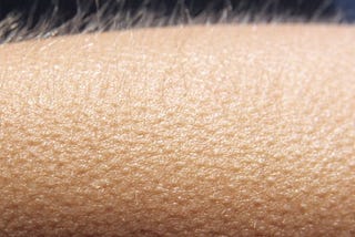 What are GooseBumps? — The Prodigious