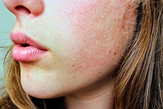 How To Begin Your Skincare Journey