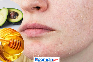 At home remedies for dry skin on face