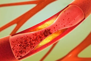 Cholesterol is not bad for us until and unless it is present in the right amount.