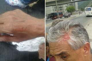“Por escuálidos” asaltan a firmantes en autobuses que iban a Macarao