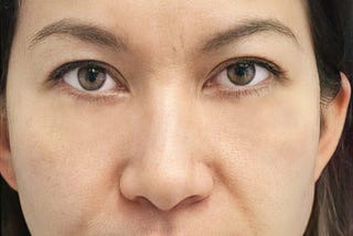How to Remove Eye Bags Fabulously in Photo for Free