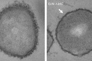 Microbial Cocoon Helps Cells Penetrate, Shrink Tumors