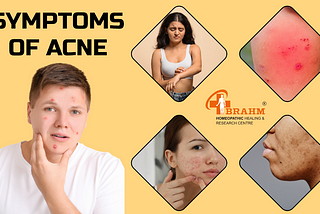 Acne treatment in homeopathy