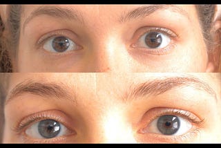 Change Eye Color Permanently With Laser Procedure