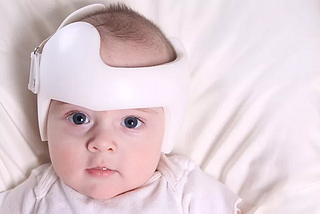 Can headband help to shape baby’s head