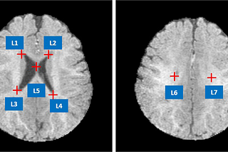 MRI Cross-Modality Image-to-Image Translation with CycleGAN