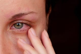 Alcoholic Eyes Meaning and Symptoms