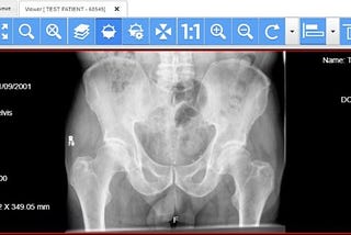 Product Review: Cross-Platform HTML5 Compliant Medical Imaging with LEADTOOLS