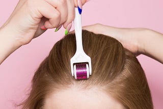 Treating and Preventing Alopecia with Scalp Microneedling