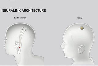 Neuralink