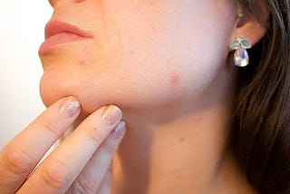 How to take care of sensitive combination skin?