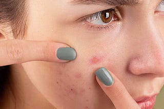 STD on Face: Symptoms, Risks, and Prevention Tips