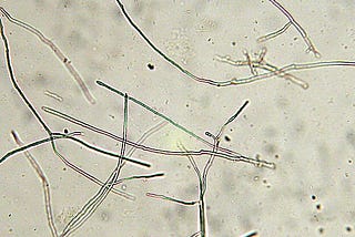 Is Mold a Fungus or Bacteria? Understanding the Science Behind Mold