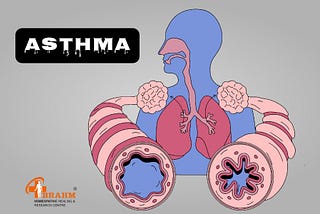 asthma treatment
