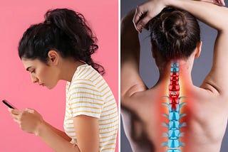 Our Phone Usage Is Gifting Us ‘Text Necks’ Now: What Are They?