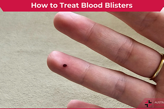 Blood blister article header