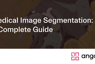 Medical Image Segmentation: A Complete Guide
