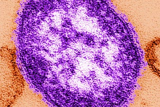 Microscopic image of a single measles virus particle stained in purple, showing its spherical shape and textured surface.