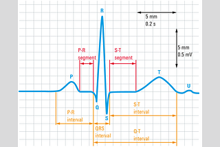 Elektrokardiyografi (EKG) Sinyallerindeki Aritmilerin Sınıflandırılması*