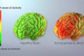 Schizophrenia and Bipolar Disorder: The Overlap