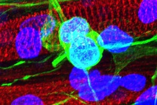 Neuromuscular Diseases: Study shows how our muscles and neurons connect